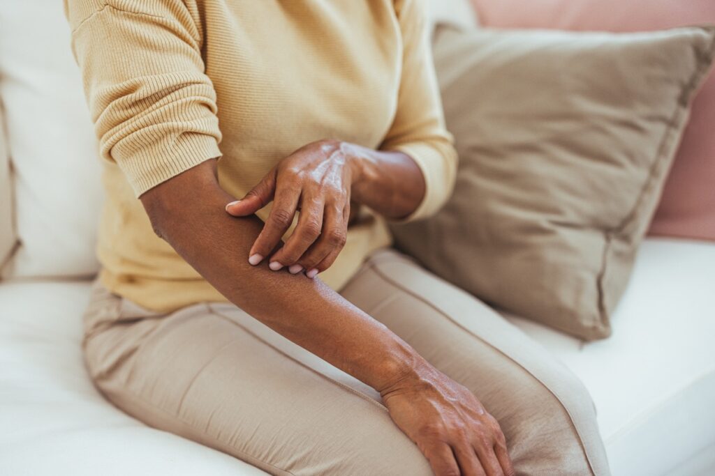 Woman Sitting on Couch Scratching Her Arm Gently